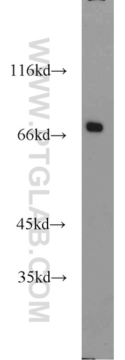 [23136-1-AP-20UL] CADM4 Polyclonal antibody