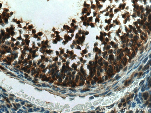 [23138-1-AP-20UL] GLIS1 Polyclonal antibody