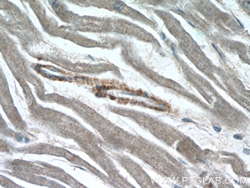 [23163-1-AP-150UL] ZFYVE19 Polyclonal antibody