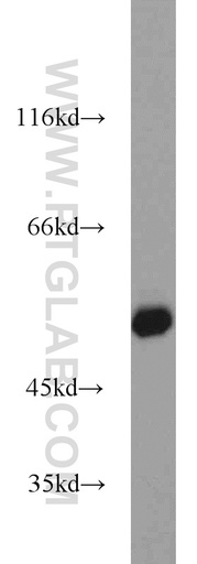 [23164-1-AP-150UL] ZSCAN21 Polyclonal antibody