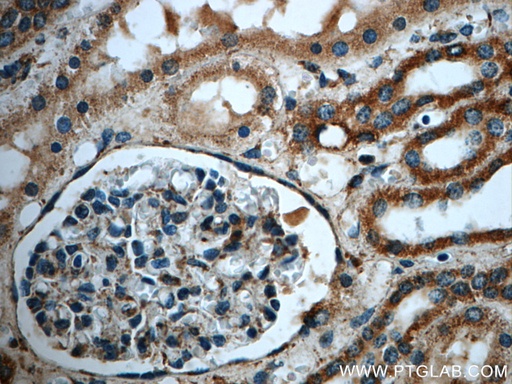 [23178-1-AP-150UL] MGME1 Polyclonal antibody