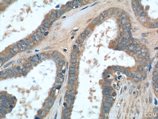 [23182-1-AP-20UL] TMEM77 Polyclonal antibody