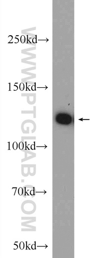 [23184-1-AP-20UL] C20orf194 Polyclonal antibody