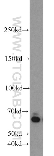[23203-1-AP-150UL] ZGPAT Polyclonal antibody