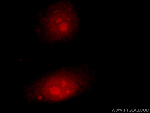 [23206-1-AP-20UL] Claspin Polyclonal antibody