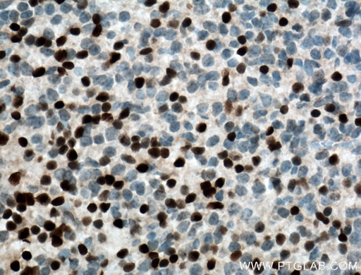 [23216-1-AP-20UL] DLX6 Polyclonal antibody
