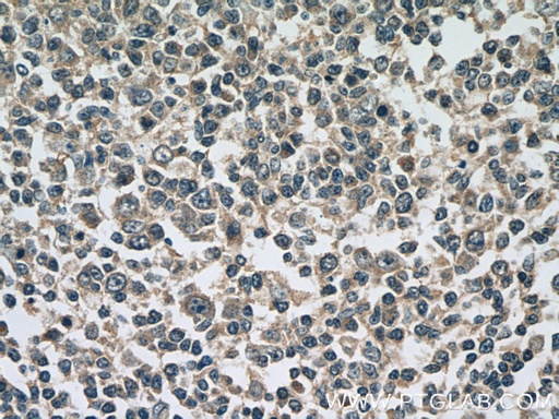 [23226-1-AP-150UL] ATG2A Polyclonal antibody