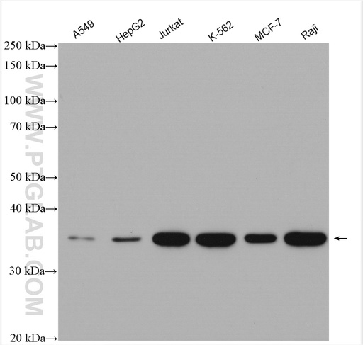 [23230-1-AP-20UL] MYD88 Polyclonal antibody