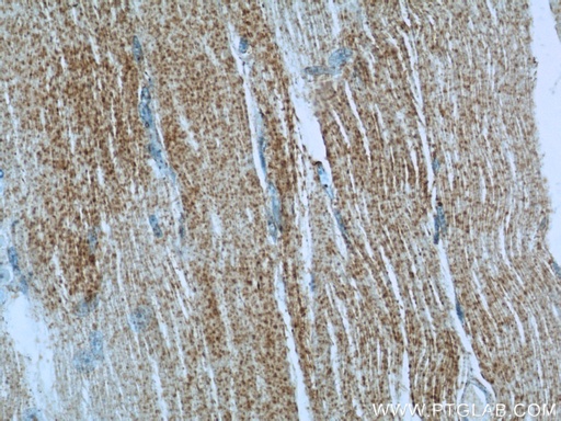 [23239-1-AP-150UL] IRGQ Polyclonal antibody
