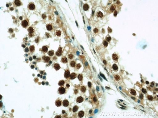 [23243-1-AP-20UL] ZNF311 Polyclonal antibody