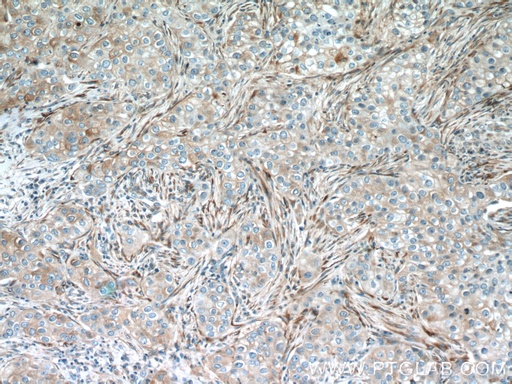 [23247-1-AP-150UL] IFIT1 Polyclonal antibody