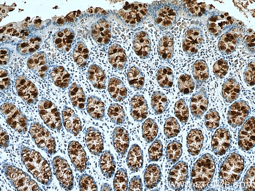 [23277-1-AP-20UL] Trefoil factor 3 Polyclonal antibody