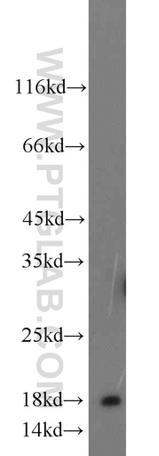 [23280-1-AP-150UL] A2LD1 Polyclonal antibody
