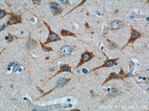 [23288-1-AP-20UL] TRIF/TICAM1 Polyclonal antibody