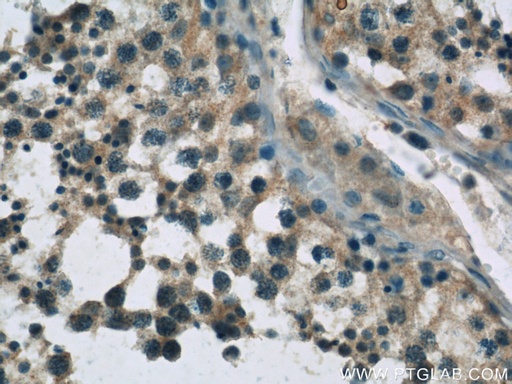 [23301-1-AP-150UL] UPF3B Polyclonal antibody