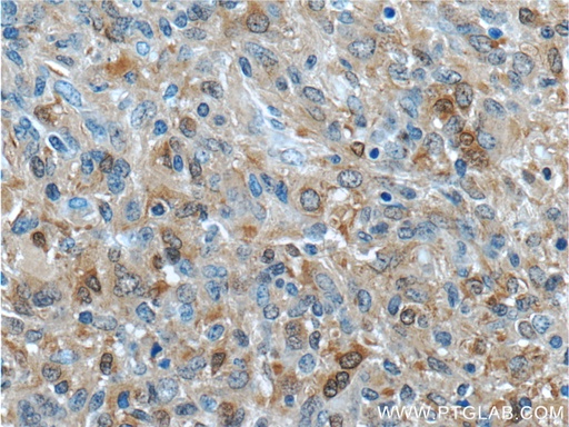 [23309-1-AP-150UL] IDH1 Polyclonal antibody