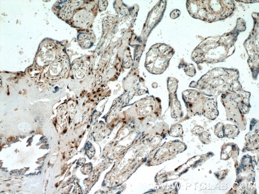[23317-1-AP-20UL] p57Kip2 Polyclonal antibody