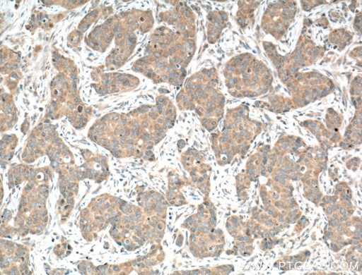 [23327-1-AP-150UL] CAMLG Polyclonal antibody