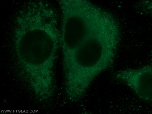 [23333-1-AP-20UL] Eg5 Polyclonal antibody
