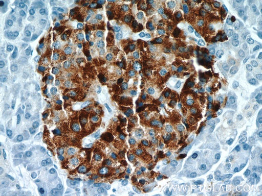 [23342-1-AP-150UL] Chromogranin A Polyclonal antibody
