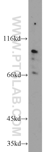 [23349-1-AP-150UL] TMTC1 Polyclonal antibody