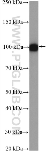 [23351-1-AP-150UL] AMOTL2 Polyclonal antibody