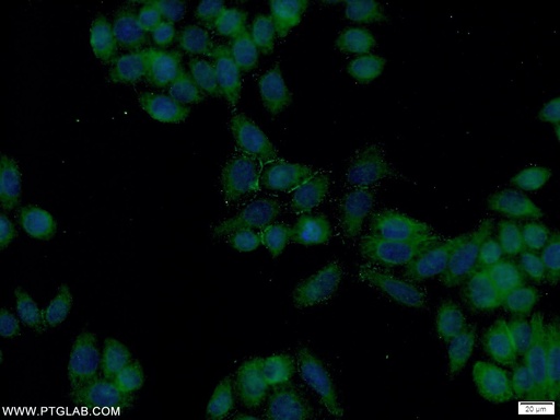 [23355-1-AP-20UL] FOLR1 Polyclonal antibody
