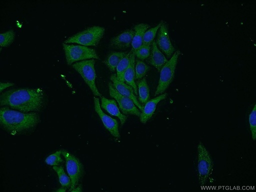[23372-1-AP-150UL] UBQLN3 Polyclonal antibody