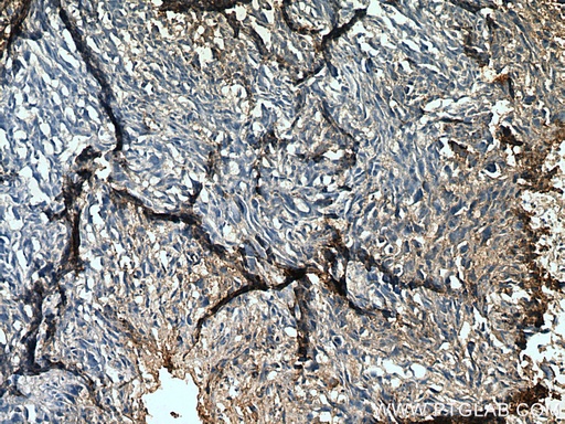[23408-1-AP-150UL] RANKL Polyclonal antibody