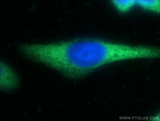 [23411-1-AP-150UL] DNAJC21 Polyclonal antibody
