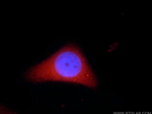 [23425-1-AP-20UL] ADH7 Polyclonal antibody