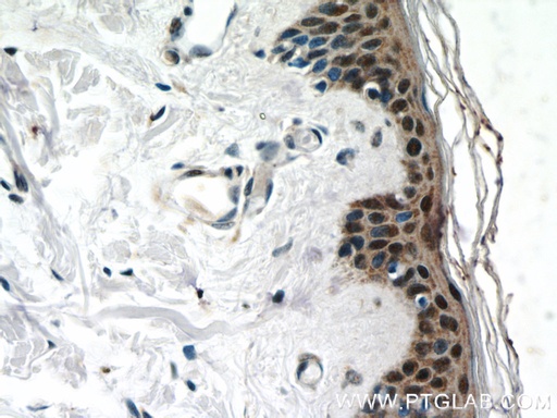 [23426-1-AP-20UL] CBX6 Polyclonal antibody