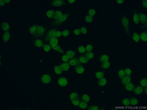 [23431-1-AP-20UL] CEBPB Polyclonal antibody