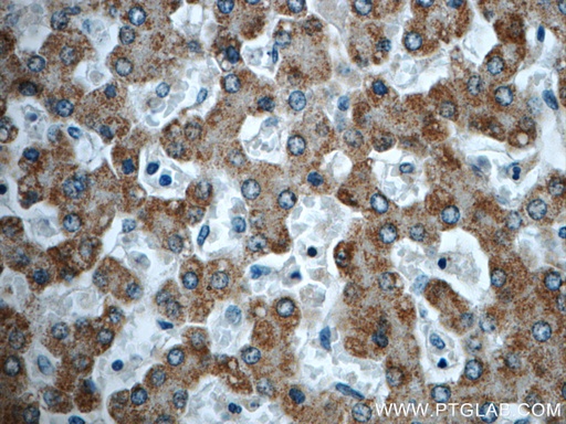 [23432-1-AP-20UL] TTC39B Polyclonal antibody