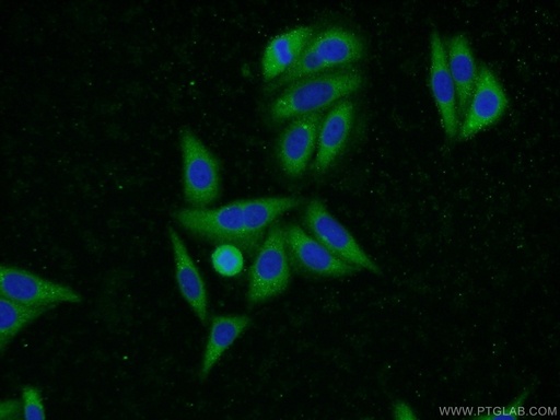 [23449-1-AP-150UL] UBQLN2 Polyclonal antibody
