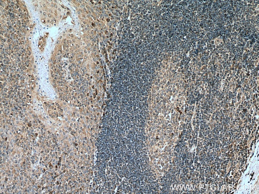 [23457-1-AP-20UL] IL-6R Polyclonal antibody