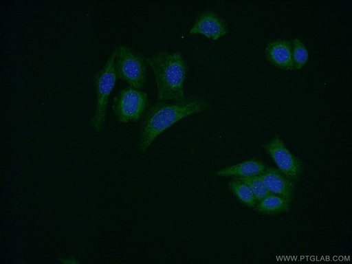 [23479-1-AP-20UL] AMH Polyclonal antibody