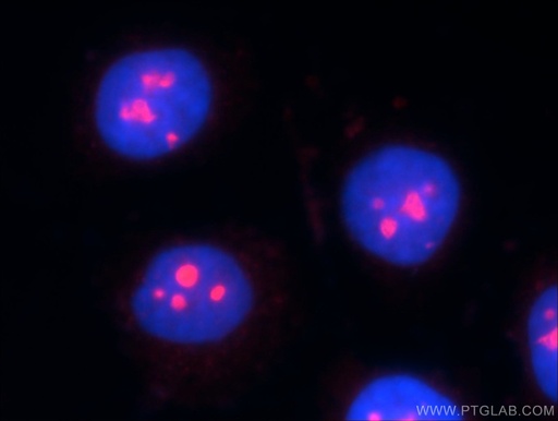 [23496-1-AP-20UL] ESF1 Polyclonal antibody