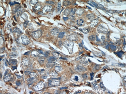 [23501-1-AP-20UL] Mammaglobin A Polyclonal antibody