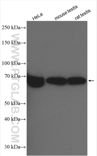 [23525-1-AP-20UL] ESCO2 Polyclonal antibody