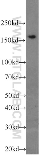 [23540-1-AP-150UL] PCF11 Polyclonal antibody