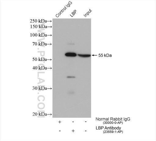 [23559-1-AP-150UL] LBP Polyclonal antibody