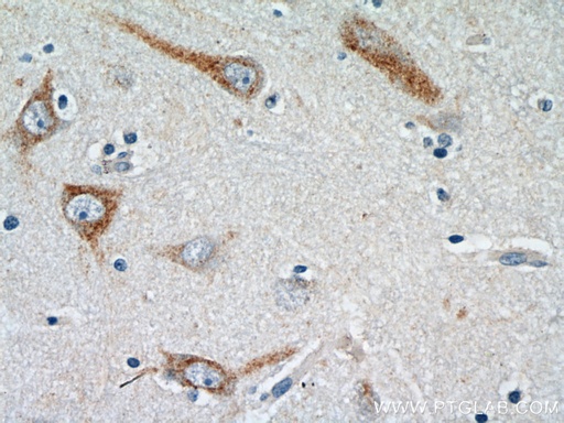[23561-1-AP-150UL] HTR6 Polyclonal antibody