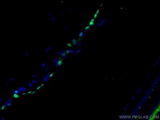[23566-1-AP-150UL] VSX1 Polyclonal antibody