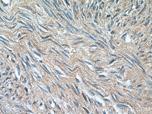 [23567-1-AP-20UL] SMTN Polyclonal antibody