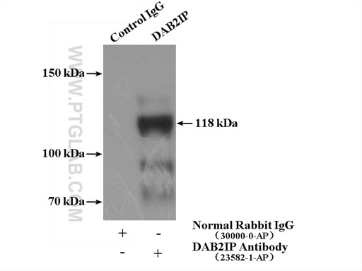 [23582-1-AP-20UL] DAB2IP Polyclonal antibody