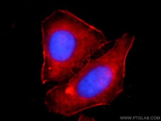 [23660-1-AP-20UL] Alpha Actin Polyclonal antibody