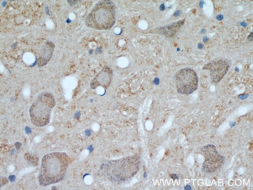 [23673-1-AP-20UL] UCP1 Polyclonal antibody