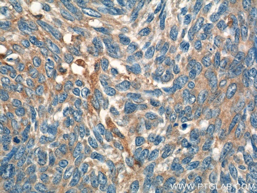[23705-1-AP-150UL] IL-19 Polyclonal antibody