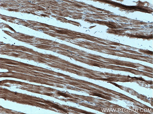 [23724-1-AP-150UL] AIDA Polyclonal antibody